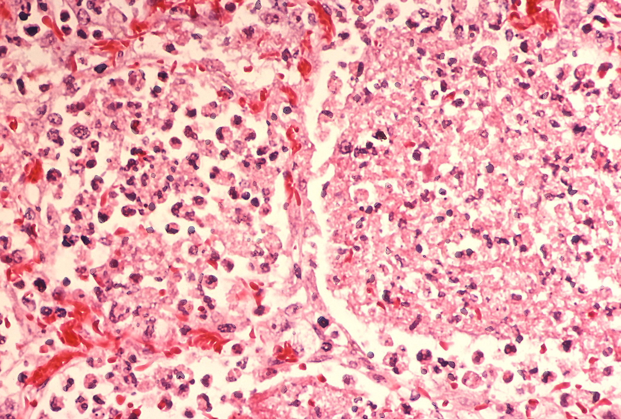 Legionnaires’ Outbreak London Ontario July 2025: Causes, Prevention & Expert Advice