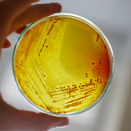 Bacteria in Water Testing (E. coli & Total Coliforms)